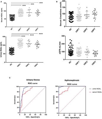 Serum and Urinary Neutrophil Gelatinase-Associated Lipocalin Levels as Early Markers of the Renal Function in Patients With Urinary Stone-Induced Hydronephrosis